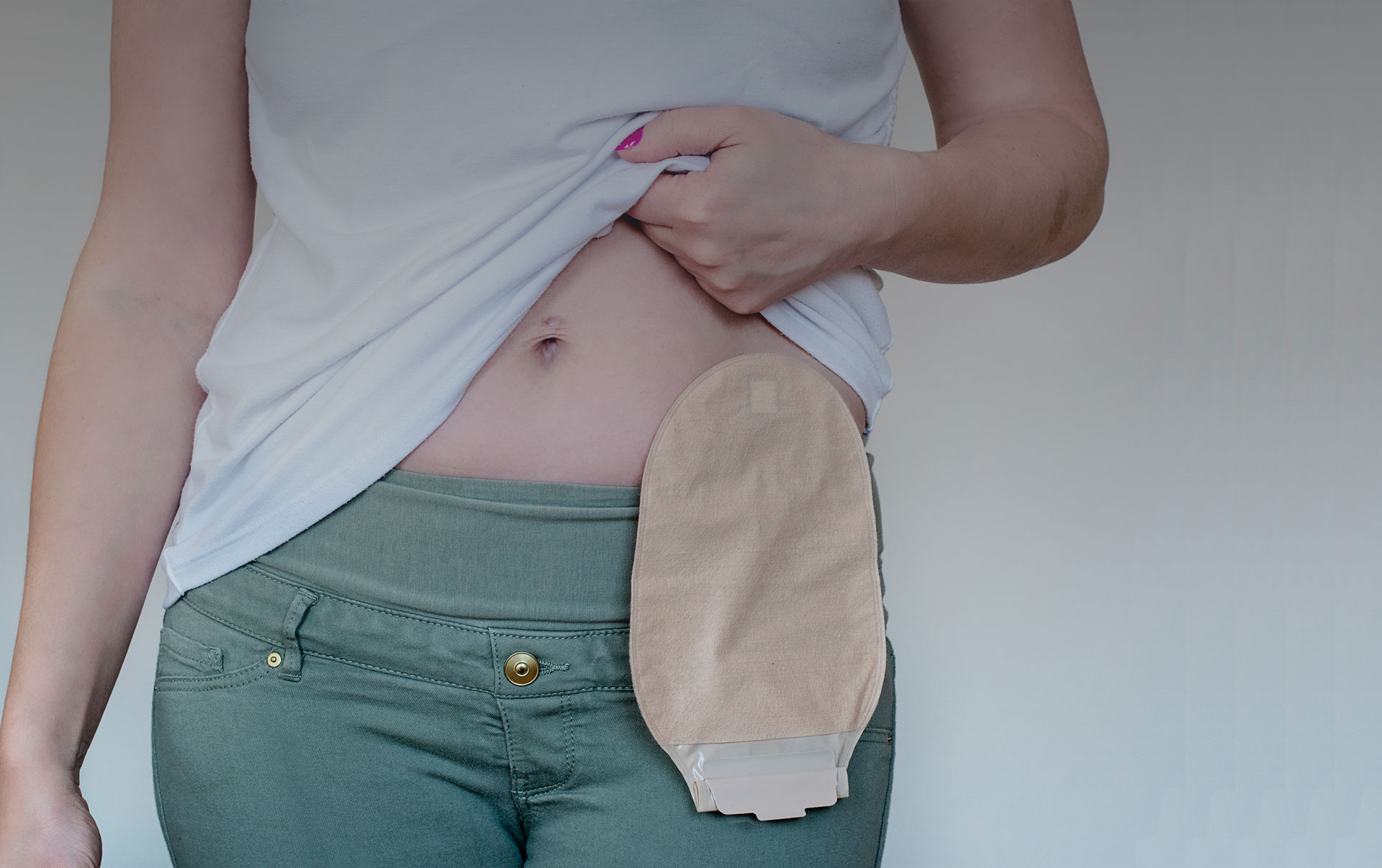 Stop Stoma Leakage: Tips to Help You Avoid Messy Situations - Personally  Delivered Blog